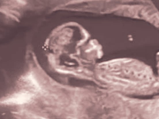 Our little girl at 12 weeks